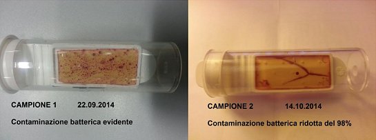 Eliminazione di batteri e alghe